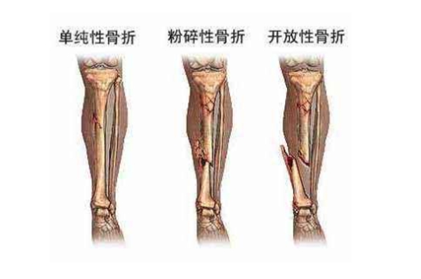 中国骨外科医院排名top100