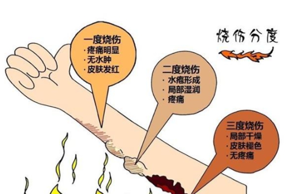 全国最佳烧伤科医院排名top100