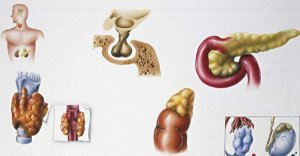 内分泌科哪家医院好?盘点全国内分泌最好的医院排名