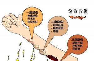 国内著名烧伤医院有哪些?全国最佳烧伤科医院排名top100