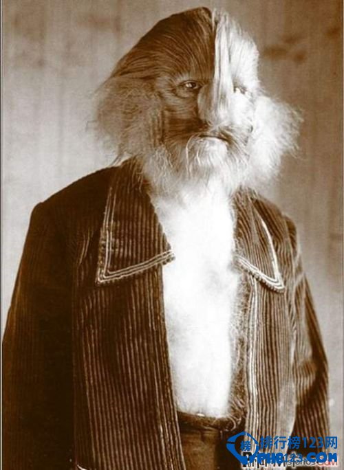 世界上最奇怪的病