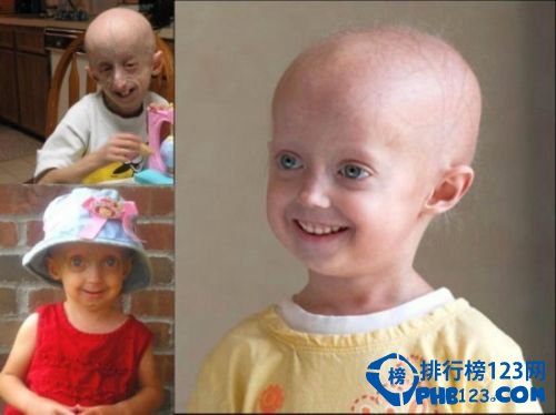 世界上最奇怪的病