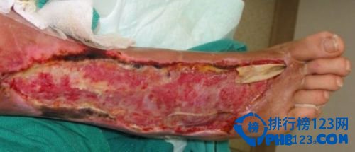 世界上最奇怪的病