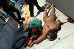 美国食脸男鲁迪·尤金,吸毒后裸奔啃掉路人整张脸